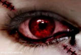 bloody_eye