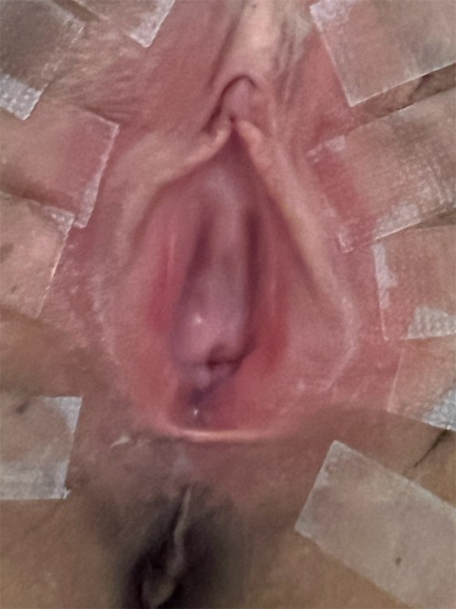 mFhpH.jpg